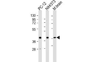 All lanes : Anti-Rnf2 Antibody (Center) at 1:2000 dilution Lane 1: PC-12 whole cell lysates Lane 2: NIH/3T3 whole cell lysates Lane 3: mouse brain lysates Lysates/proteins at 20 μg per lane.