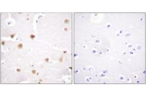 Immunohistochemistry (IHC) image for anti-Jun Proto-Oncogene (JUN) (AA 221-270) antibody (ABIN2888807) (C-JUN Antikörper  (AA 221-270))