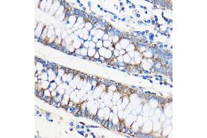 Immunohistochemistry of paraffin-embedded Human colon using ApoM Rabbit pAb (ABIN6127365, ABIN6137030, ABIN6137031 and ABIN6220968) at dilution of 1:50 (40x lens). (Apolipoprotein M Antikörper  (AA 23-188))