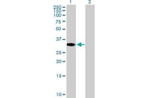 Western Blot analysis of ZNF101 expression in transfected 293T cell line by ZNF101 MaxPab polyclonal antibody. (ZNF101 Antikörper  (AA 1-316))