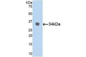 Detection of Recombinant MAPK9, Human using Polyclonal Antibody to Mitogen Activated Protein Kinase 9 (MAPK9) (JNK2 Antikörper  (AA 130-387))