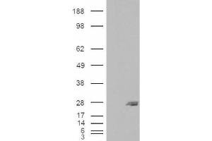 Western Blotting (WB) image for anti-SAR1 Homolog B (SAR1B) (Internal Region) antibody (ABIN2466238) (SAR1B Antikörper  (Internal Region))
