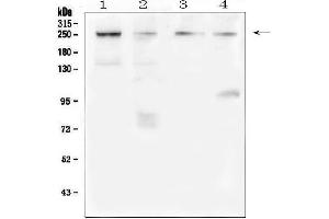 Western blot analysis of TRPM7 using anti-TRPM7 antibody (ABIN6719305).