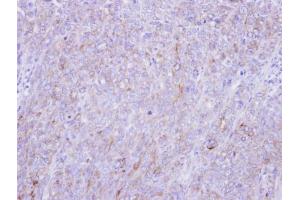 IHC-P Image Immunohistochemical analysis of paraffin-embedded DLD-1 xenograft, using Glypican-1, antibody at 1:100 dilution. (GPC1 Antikörper)