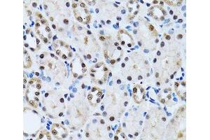 Immunohistochemistry of paraffin-embedded Rat kidney using CCAR2 Polyclonal Antibody at dilution of 1:100 (40x lens). (CCAR2 Antikörper)