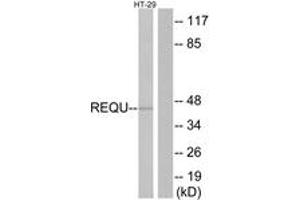 Western blot analysis of extracts from HT-29 cells, using REQU Antibody.