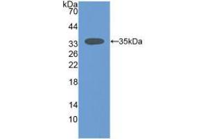 Western blot analysis of recombinant Mouse SIRT2. (SIRT2 Antikörper  (AA 65-340))