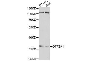 Western blot analysis of extracts of various cell lines, using GTF2A1 antibody (ABIN1876533) at 1:1000 dilution. (GTF2A1 Antikörper)