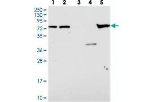 Western blot analysis of Lane 1: RT-4, Lane 2: U-251 MG, Lane 3: Human Plasma, Lane 4: Liver, Lane 5: Tonsil with KBTBD8 polyclonal antibody . (KBTBD8 Antikörper)