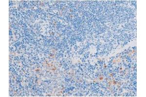 Immunohistochemistry (IHC) image for anti-LIM Domain Kinase 1 (LIMK1) (pThr508) antibody (ABIN6255701)