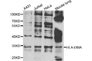 Western blot analysis of extracts of various cell lines, using HLA-DMA antibody (ABIN5975269) at 1/1000 dilution. (HLA-DMA Antikörper)