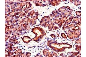 IHC image of ABIN7142105 diluted at 1:1000 and staining in paraffin-embedded human pancreatic tissue performed on a Leica BondTM system. (14-3-3 zeta Antikörper  (AA 133-212))