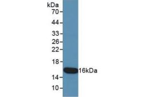 WB of Protein Standard: different control antibodies against Highly purified E. (KRT15 ELISA Kit)