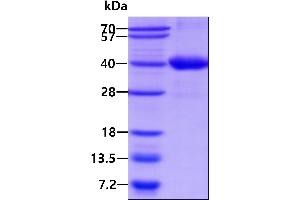 SDS-PAGE (SDS) image for Signal Transducing Adaptor Family Member 1 (STAP1) protein (His tag) (ABIN1098624)