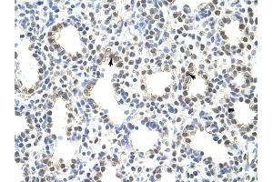 PRMT5 antibody was used for immunohistochemistry at a concentration of 4-8 ug/ml to stain Alveolar ceils (arrows) in Human Lung. (PRMT5 Antikörper  (N-Term))