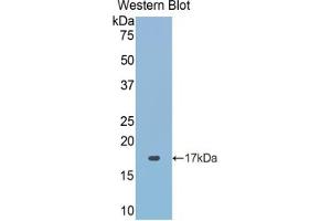 Western blot analysis of the recombinant protein. (ACP1 Antikörper  (AA 40-158))