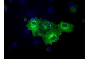 Immunofluorescence (IF) image for anti-Fermitin Family Member 2 (FERMT2) antibody (ABIN1499049) (FERMT2 Antikörper)