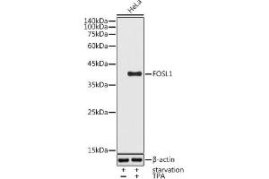 Western blot analysis of extracts of HeLa cells, using FOSL1 antibody (ABIN6131653, ABIN6140738, ABIN6140739 and ABIN6221016) at 1:1000 dilution. (FOSL1 Antikörper  (AA 1-100))