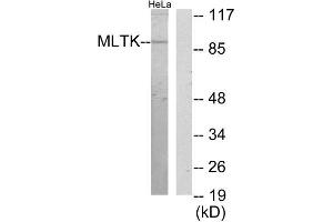 Western Blotting (WB) image for anti-Mitogen-Activated Protein Kinase Kinase Kinase MLT (ZAK) (C-Term) antibody (ABIN1850018) (ZAK Antikörper  (C-Term))