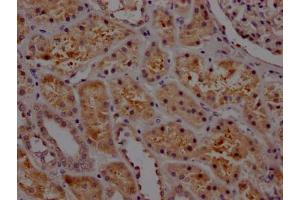 IHC image of ABIN7127662 diluted at 1:100 and staining in paraffin-embedded human kidney tissue performed on a Leica BondTM system. (Rekombinanter PAI1 Antikörper)