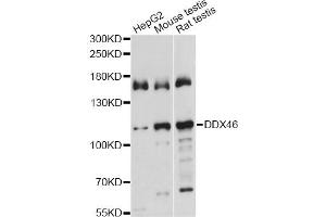 Western blot analysis of extracts of various cell lines, using DDX46 antibody. (DDX46 Antikörper)