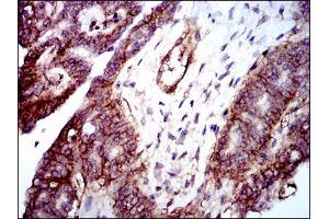 Image no. 2 for anti-Integrin beta 1 (ITGB1) antibody (ABIN1498894) (ITGB1 Antikörper)