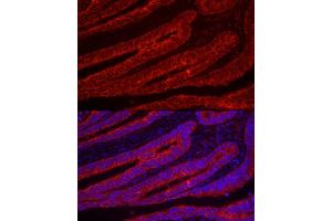 Immunofluorescence analysis of human colon carcinoma using TFF3 Rabbit pAb (ABIN6128142, ABIN6149051, ABIN6149052 and ABIN6219136) at dilution of 1:100 (40x lens). (TFF3 Antikörper  (AA 22-94))