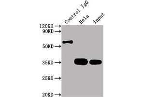 Immunoprecipitating CDK4 in Hela whole cell lysate Lane 1: Rabbit control IgG instead of ABIN7127418 in Hela whole cell lysate. (Rekombinanter CDK4 Antikörper)