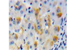 IHC-P analysis of Liver tissue, with DAB staining. (MMP15 Antikörper  (AA 336-539))