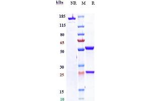 Anti- Human CLDN18. (Rekombinanter CLDN18.2 (Zolbetuximab Biosimilar) Antikörper)