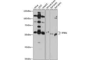 Western blot analysis of extracts of various cell lines, using IP6K1 antibody (ABIN6131922, ABIN6142500, ABIN6142501 and ABIN6215821) at 1:1000 dilution. (IP6K1 Antikörper  (AA 1-220))