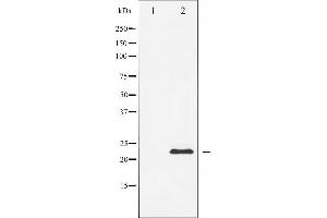 Western blot analysis of Caveolin-1 expression in NIH-3T3 whole cell lysates,The lane on the left is treated with the antigen-specific peptide.
