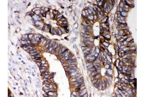 Immunohistochemistry (IHC) image for anti-Major Histocompatibility Complex, Class I, A (HLA-A) (AA 82-106), (N-Term) antibody (ABIN3043842)