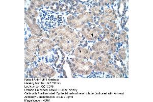 Immunohistochemistry (IHC) image for anti-Polyamine Modulated Factor 1 (PMF1) (N-Term) antibody (ABIN2780837)