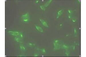 Immunofluorescence staining of human LNCap cell colony with monoclonal anti- human STEAP1 antibody. (STEAP1 Antikörper  (AA 1-70))