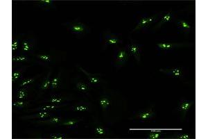 Immunofluorescence of purified MaxPab antibody to KIAA0020 on HeLa cell. (KIAA0020 Antikörper  (AA 1-648))