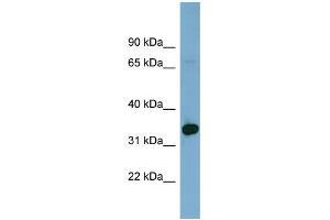 WB Suggested Anti-HOXD12 Antibody Titration: 0. (HOXD12 Antikörper  (Middle Region))
