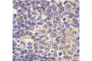 Immunohistochemistry of TLR1 in mouse spleen tissue with this product at 10 μg/ml.