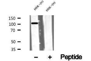 Western blot analysis of extracts of HEK-293 cells, using VPS11 antibody. (VPS11 Antikörper  (Internal Region))