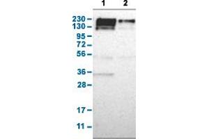 Western Blot analysis with PARP4 polyclonal antibody . (PARP4 Antikörper  (AA 247-392))