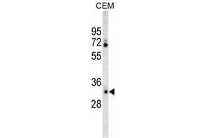 Western blot analysis of CA6 Antibody (C-term) in CEM cell line lysates (35µg/lane).