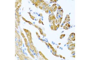Immunohistochemistry of paraffin-embedded mouse heart using COL9A3 antibody. (COL9A3 Antikörper)