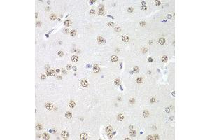 Immunohistochemistry of paraffin-embedded rat brain using PRMT5 antibody at dilution of 1:100 (x40 lens). (PRMT5 Antikörper)