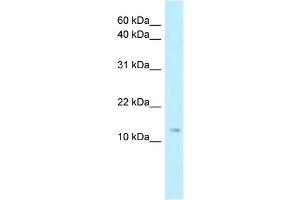 WB Suggested Anti-Stmn1 Antibody Titration: 1. (Stathmin 1 Antikörper  (N-Term))
