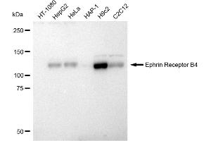 anti-Ephrin Receptor B4 antibody