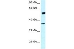 Image no. 1 for anti-Homer Homolog 3 (Drosophila) (HOMER3) (C-Term) antibody (ABIN6747696)