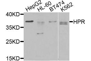 Western blot analysis of extracts of various cells, using HPR antibody. (HPR Antikörper)