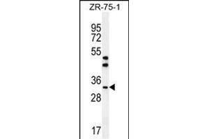 AREG Antibody (C-term) (ABIN392202 and ABIN2841903) western blot analysis in ZR-75-1 cell line lysates (35 μg/lane).