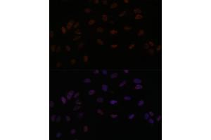 Immunofluorescence analysis of U-2 OS cells using PPP4R3B antibody (ABIN7270374) at dilution of 1:100.