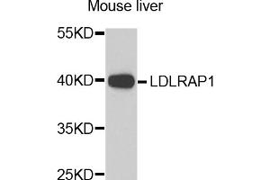 Western blot analysis of extracts of mouse liver, using LDLRAP1 antibody (ABIN5974266) at 1/1000 dilution. (LDLRAP1 Antikörper)